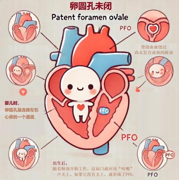 
广州医科大学附属口腔医院黄牛号贩子票贩子代网上预约代挂号电话科普｜卵圆孔未闭：心脏里的“小门”没关好？